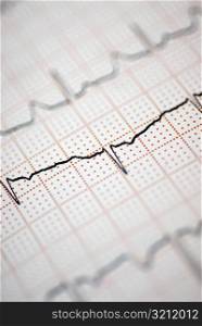 Close-up of an electrocardiogram report