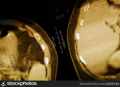 Close-up of an MRI scan