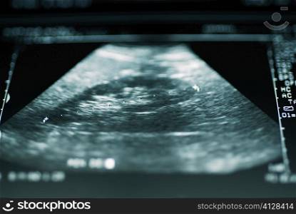 Close-up of an ultrasound