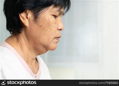 Close-up of Asian elder woman face with wrinkled skin condition. side view