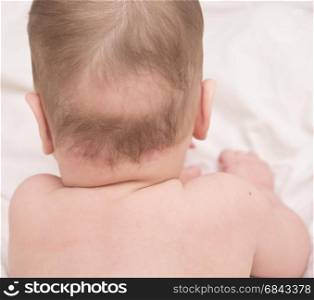 close up of baby bald patch