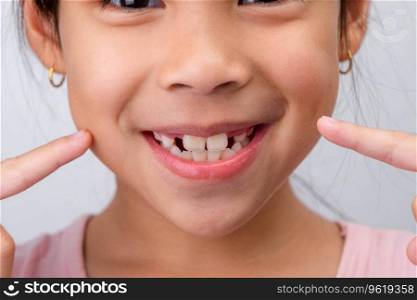 Close-up of cute young girl smiling wide, showing empty space with growing first front teeth. Little girl with big smile and missing milk teeth. Dental hygiene concept