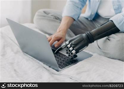 Close up of disabled woman working on laptop typing on keyboard, using bionic prosthetic arm, sits on bed. Female with disability uses keypad by artificial robotic hand. Modern prosthesis advertising.. Close up of disabled woman working on laptop, typing on keyboard, using bionic prosthetic arm