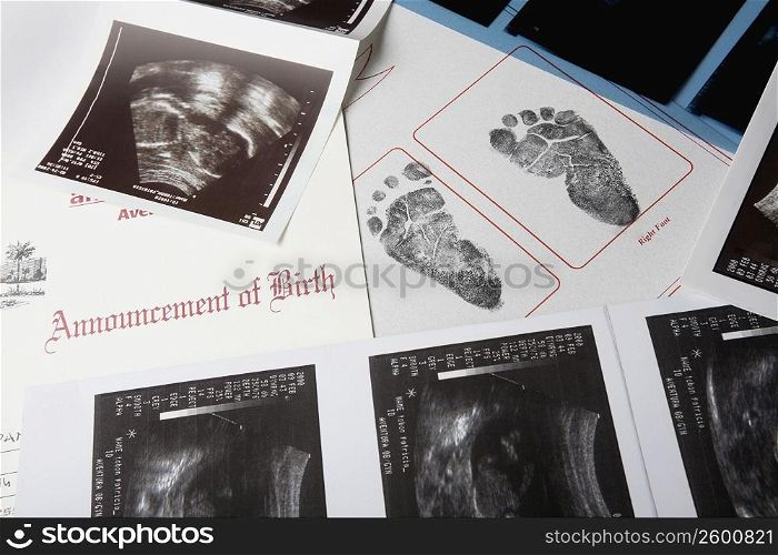 Close-up of footprints and an ultrasound report