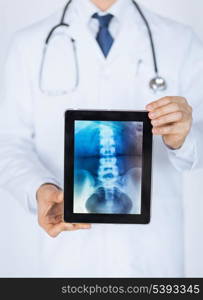 close up of male doctor holding tablet pc with x-ray
