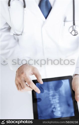 close up of male doctor holding tablet pc with x-ray