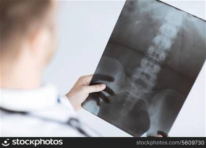 close up of male doctor holding x-ray or roentgen image