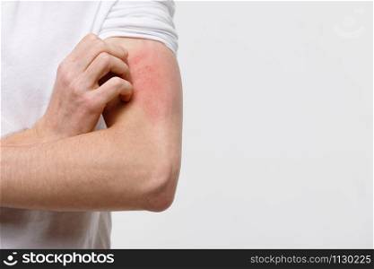 Close up of male scratching the itch on his hand, isolated on grey background, copy space. Pruritus, animal/food/cosmetic allergy, dermatitis, insect bites, irritation concept.