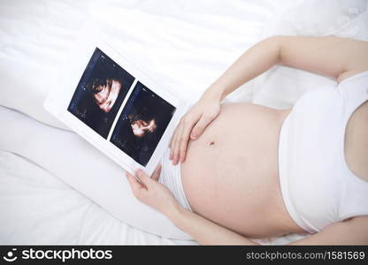 Close up of pregnant woman holding ultrasound scan on her tummy