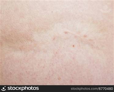 close up of scar on human skin