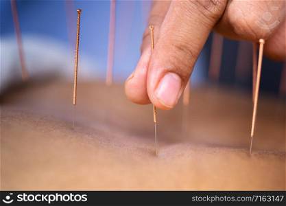 Close-up of senior female back with steel needles during procedure of the acupuncture therapy