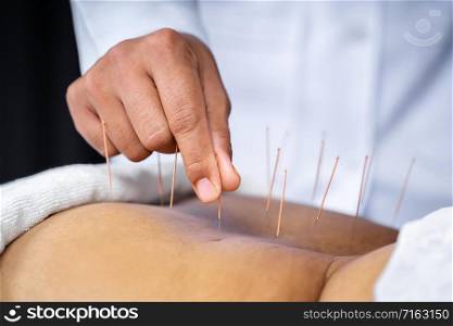 Close-up of senior female back with steel needles during procedure of the acupuncture therapy
