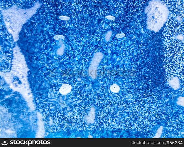 Close-Up Of Whirlpool Bubble In Hot Tub
