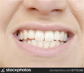 close up of woman teeth