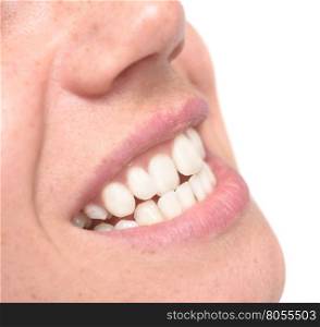 close up shot of crooked teeth