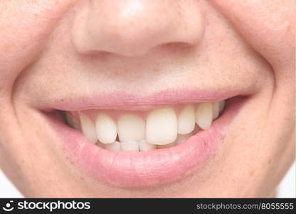 close up shot of crooked teeth