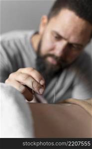 close up therapist holding acupuncture needle
