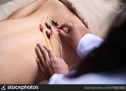 close up woman undergoing acupuncture treatment with electrical stimulator on back