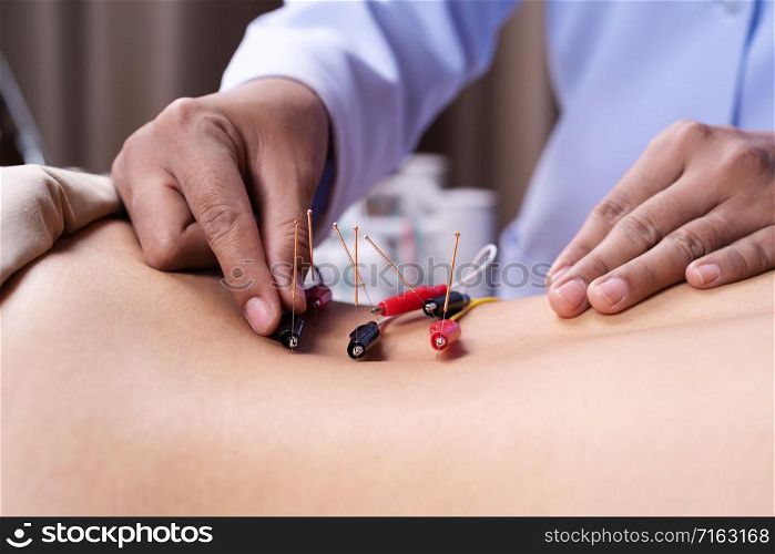 close up woman undergoing acupuncture treatment with electrical stimulator on back