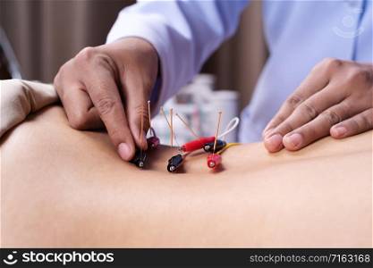 close up woman undergoing acupuncture treatment with electrical stimulator on back