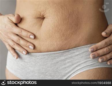 close up woman with stretch marks. Beautiful photo. close up woman with stretch marks
