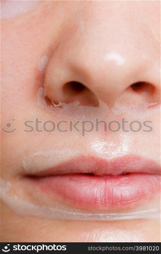 Close up young woman in facial peel off mask, part of face. Peeling. Wellness and skincare.. Close up woman in facial peel off mask.