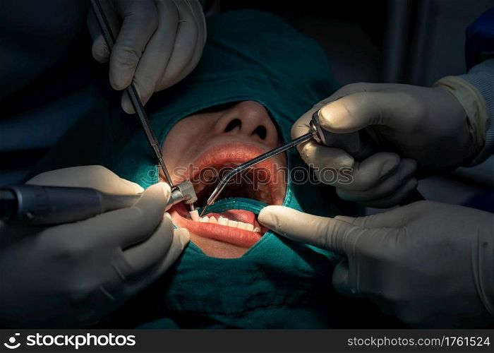 Closeup Dentist and assistant operating for checking and teeth cleaning at dental clinic, Tooth care concept.