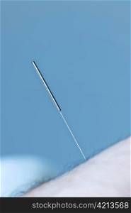 Closeup of acupuncture needle inserted in skin