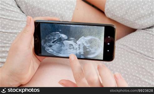 CLoseup of ultrasound image of unborn baby on smartphone screen. Concept of expecting baby, pregnancy and healthcare. CLoseup of ultrasound image of unborn baby on smartphone screen. Concept of expecting baby, pregnancy and healthcare.