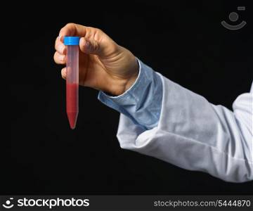 Closeup on hand of medical doctor with test tube with blood isolated on black