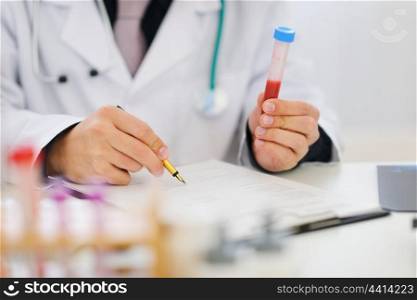 Closeup on hands of medical doctor holding blood sample and making notes