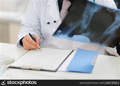 Closeup on medical doctor holding patients roentgen and making note in clipboard
