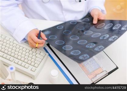 Closeup on patients tomography in hand of medical doctor