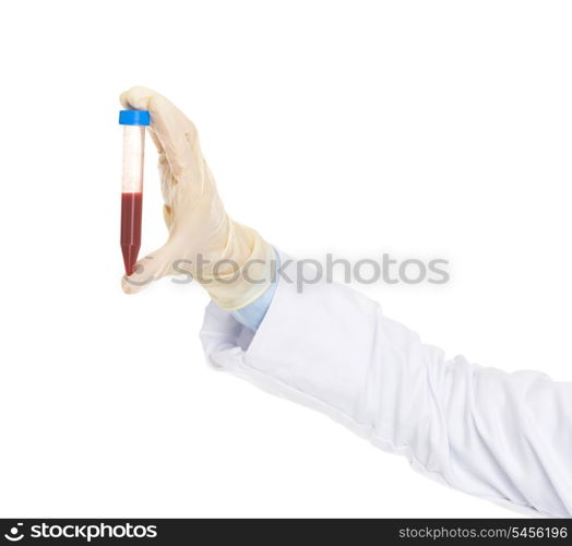 Closeup on test tube in hand of doctor