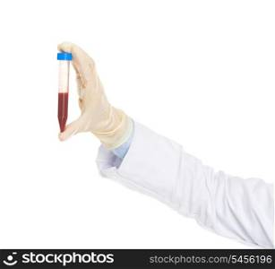 Closeup on test tube in hand of doctor