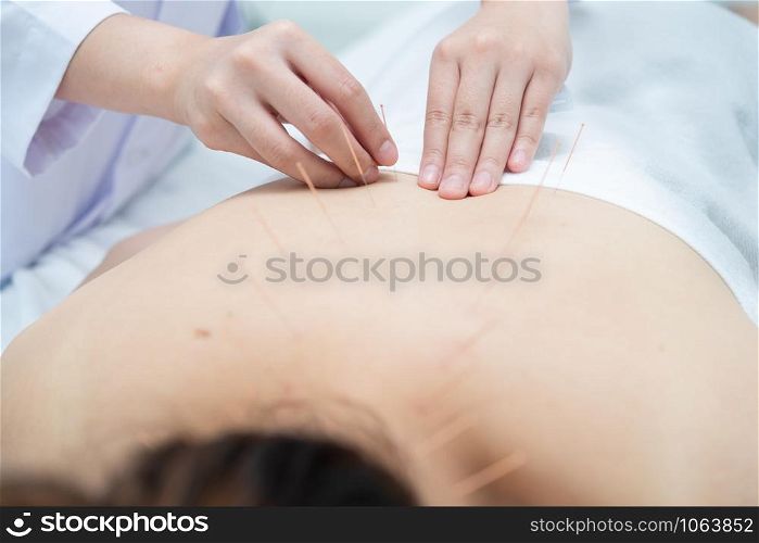 Closeup, patient getting acupuncture from acupuncturist at clinic for chinese medicine treatment.