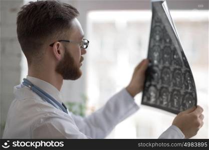 Closeup portrait of intellectual man healthcare personnel with white labcoat, looking at brain x-ray radiographic image, ct scan, mri, clinic office background. Radiology department