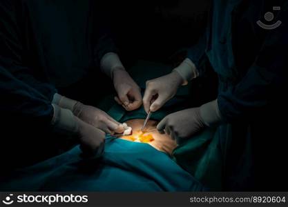 Closeup surgical team performing surgery to patient in sterile operating room. In a surgery room lit by a l&, a professional and confident surgical team provides medical care to unconscious patient.