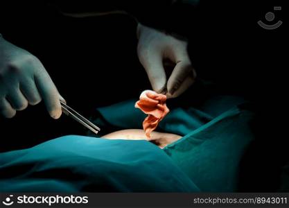 Closeup surgical team performing surgery to patient in sterile operating room. In a surgery room lit by a l&, a professional and confident surgical team provides medical care to unconscious patient.. Closeup surgical team performing surgery to patient in sterile operating room.