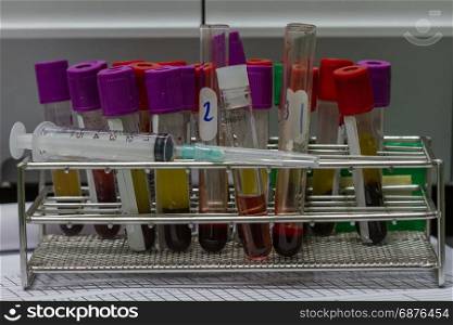 Closeup test tubes with blood for medical and biological analyzes, medicine equipment and health concept