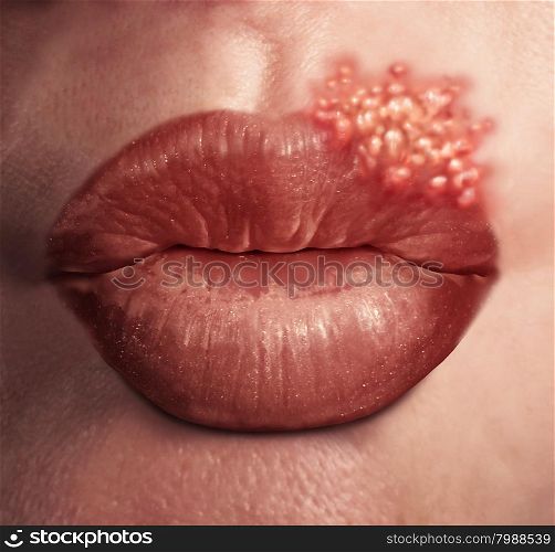 Cold sore herpes virus medical health concept as human lips with an outbreak of swollen fever blisters as an infection on skin.