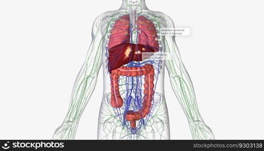 Colorectal cancer  CRC  is a common colon or rectal cancer that affects many patients over middle age. 3D rendering. Colorectal cancer  CRC  is a common colon or rectal cancer that affects many patients over middle age.