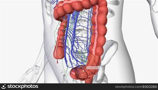 Colorectal cancer (CRC) is a common colon or rectal cancer that affects many patients over middle age. 3D rendering. Colorectal cancer (CRC) is a common colon or rectal cancer that affects many patients over middle age.