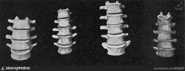 Comparative table of lumbar vertebral columns of a European, an Australian, an African man and a Dwarf man of the Philippines, vintage engraved illustration. From the Universe and Humanity, 1910.