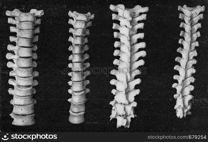 Comparative table of the vertebral column of the breast and the femur of a European and an Australian, vintage engraved illustration. From the Universe and Humanity, 1910.