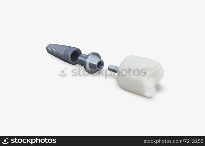 Component of Dental implant. 3D rendering illustration.