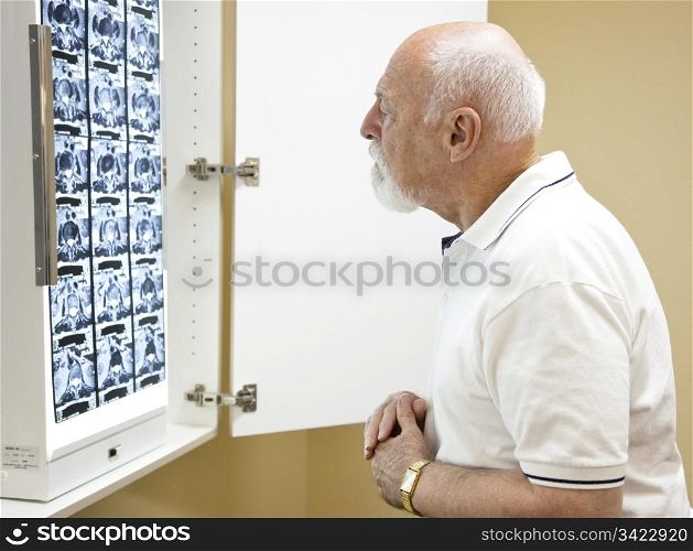 Confused senior man in chiropractors office, looking over the CT scan of his spine.