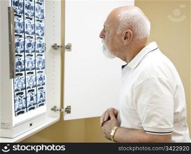 Confused senior man in chiropractors office, looking over the CT scan of his spine.