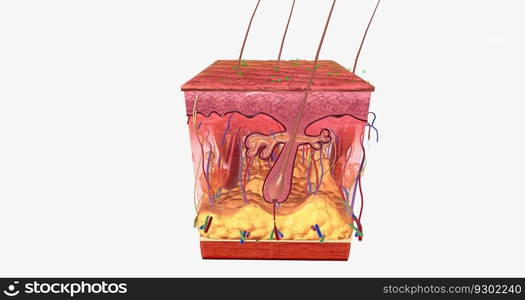 Contact Dermatitis in Skin Tissue 3D rendering. Contact Dermatitis in Skin Tissue