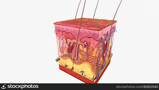 Contact Dermatitis in Skin Tissue 3D rendering. Contact Dermatitis in Skin Tissue